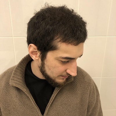 До и после проведения процедур