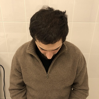 До и после проведения процедур