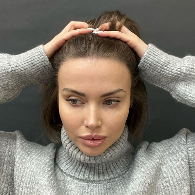 До и после проведения процедур