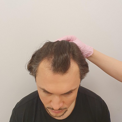 До и после проведения процедур